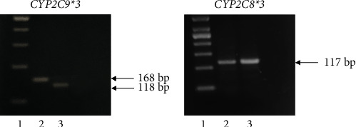 Association of <i>CYP2C9∗3</i> and <i>CYP2C8∗3</i> Non-Functional Alleles with Ibuprofen-Induced Upper Gastrointestinal Toxicity in a Saudi Patient.