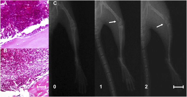 Co-Administration of nalbuphine to improve morphine tolerance in mice with bone cancer pain.