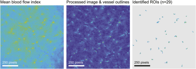 Reduced tubuloglomerular feedback activity and absence of its synchronization in a connexin40 knockout rat.