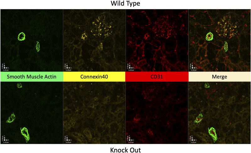 Reduced tubuloglomerular feedback activity and absence of its synchronization in a connexin40 knockout rat.