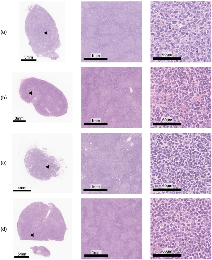 Transformer-based personalized attention mechanism for medical images with clinical records