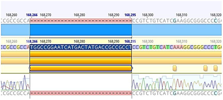 LMP1-EBV Gene Deletion Mutations and HLA Genotypes of Nasopharyngeal Cancer Patients in Vietnam.