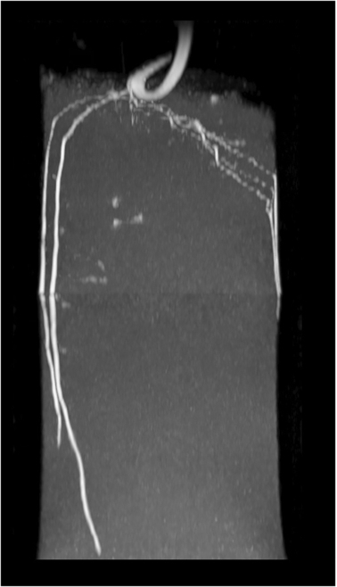 3D U-Net Segmentation Improves Root System Reconstruction from 3D MRI Images in Automated and Manual Virtual Reality Work Flows.