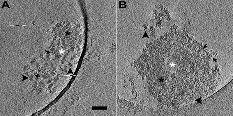 Cryo-EM tomography and automatic segmentation delineate modular structures in the postsynaptic density.