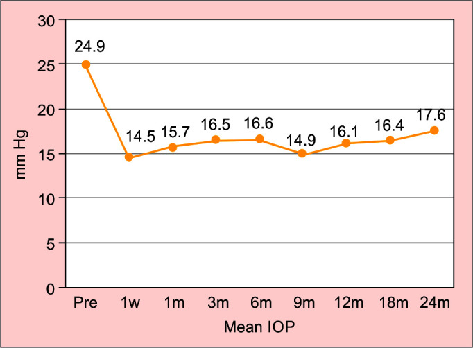 Clinical Outcomes of Micropulse Transscleral Cyclophotocoagulation: 2 Years of Experience in Portuguese Eyes.