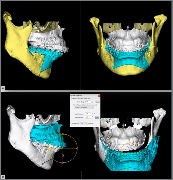 Cartesian three-dimensional method to quantify displacements between cone beam computed tomography models.