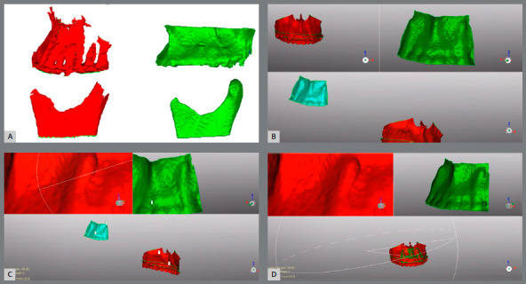 Cartesian three-dimensional method to quantify displacements between cone beam computed tomography models.