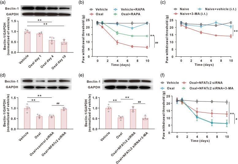 NFATc2-dependent epigenetic downregulation of the TSC2/Beclin-1 pathway is involved in neuropathic pain induced by oxaliplatin.