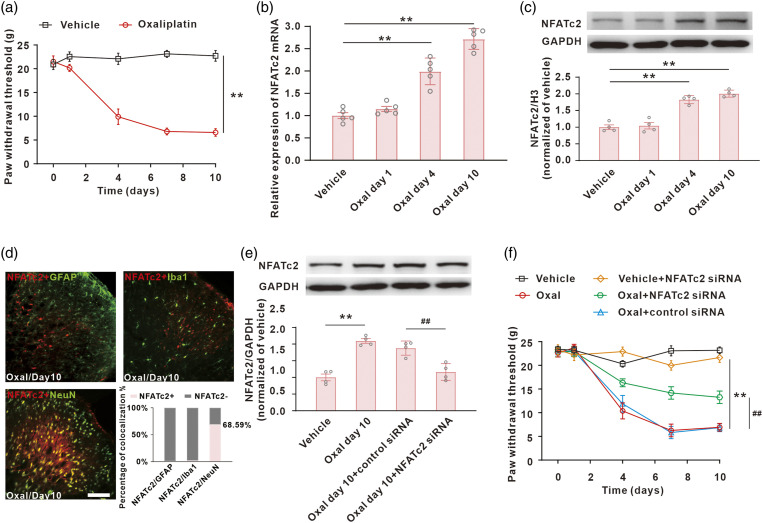 NFATc2-dependent epigenetic downregulation of the TSC2/Beclin-1 pathway is involved in neuropathic pain induced by oxaliplatin.