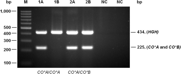 Genotyping Approach to Predict Co<sup>a</sup> and Co<sup>b</sup> Antigens in Thai Blood Donor Populations.