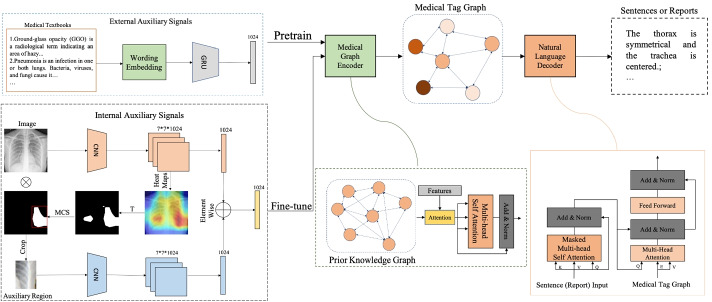 Auxiliary signal-guided knowledge encoder-decoder for medical report generation.