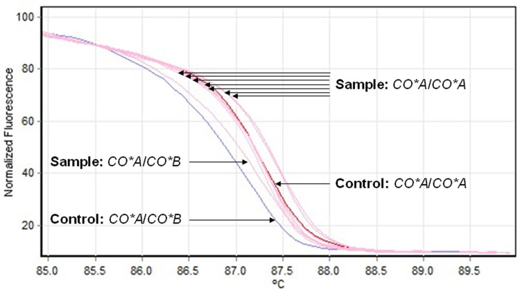 Genotyping Approach to Predict Co<sup>a</sup> and Co<sup>b</sup> Antigens in Thai Blood Donor Populations.