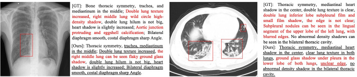 Auxiliary signal-guided knowledge encoder-decoder for medical report generation.