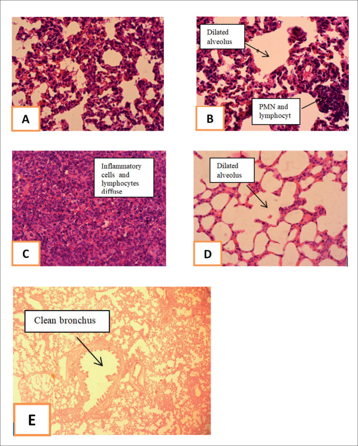 Anti Inflammatory Action of Allium Sativum Ethanol Extract to Prevent Lung Damage in Smoker Rat Model.