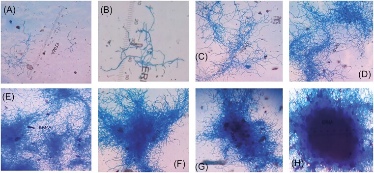 Insights into the mechanism of mycelium transformation of <i>Streptomyces toxytricini</i> into pellet.