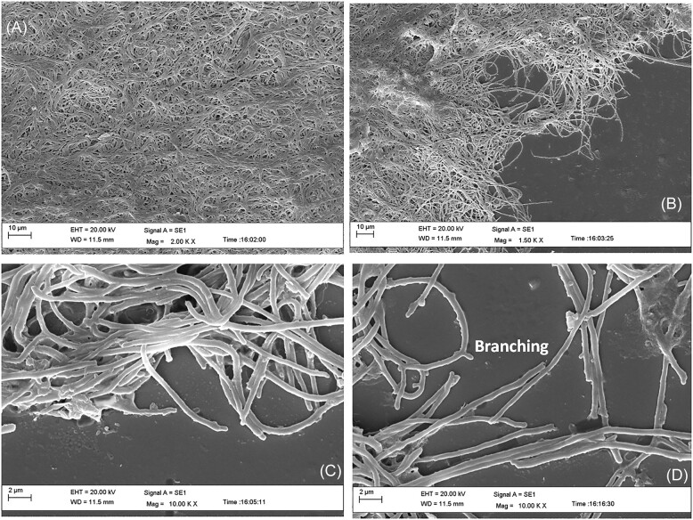 Insights into the mechanism of mycelium transformation of <i>Streptomyces toxytricini</i> into pellet.