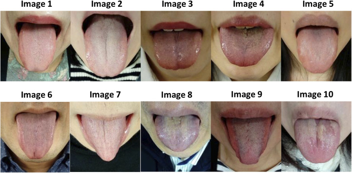 Objective evaluation of tongue diagnosis ability using a tongue diagnosis e-learning/e-assessment system based on a standardized tongue image database.