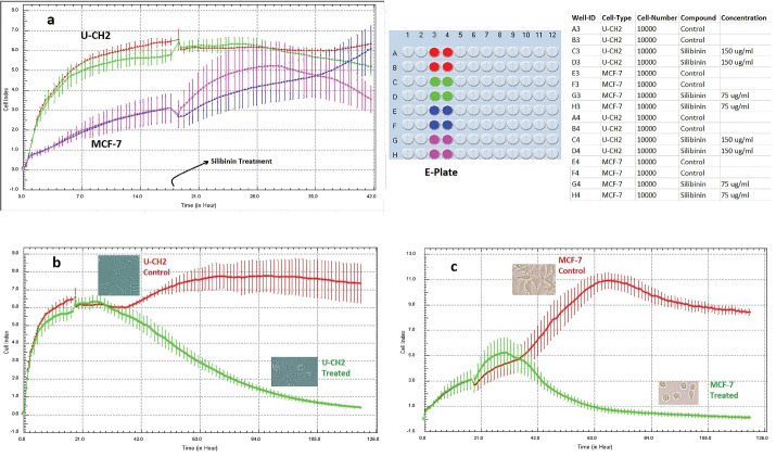 Evaluation of Silibinin Effect on U-CH2 and MCF-7 Cell Lines through xCELLigence System.