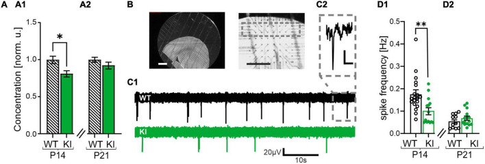 Tonic activation of GABA<sub>B</sub> receptors via GAT-3 mediated GABA release reduces network activity in the developing somatosensory cortex in GAD67-GFP mice.