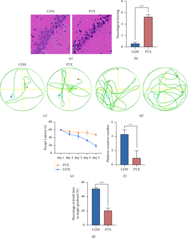 Paclitaxel Induces Neurotoxicity by Disrupting Tricarboxylic Acid Cycle Metabolic Balance in the Mouse Hippocampus.