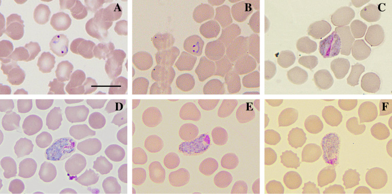 Morphological atypia and molecular profile of Plasmodium vivax: Findings from an outbreak in the Brazilian Amazon.