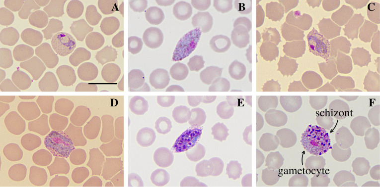 Morphological atypia and molecular profile of Plasmodium vivax: Findings from an outbreak in the Brazilian Amazon.