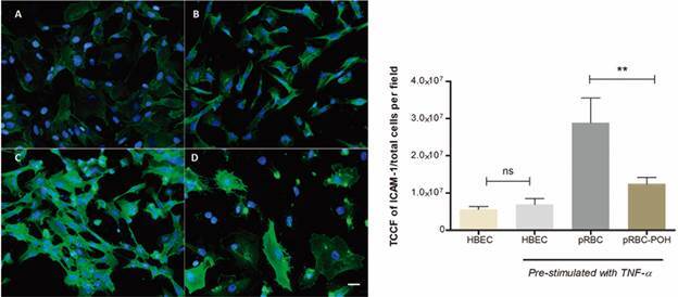 Perillyl alcohol modulates activation, permeability and integrity of human brain endothelial cells induced by Plasmodium falciparum.