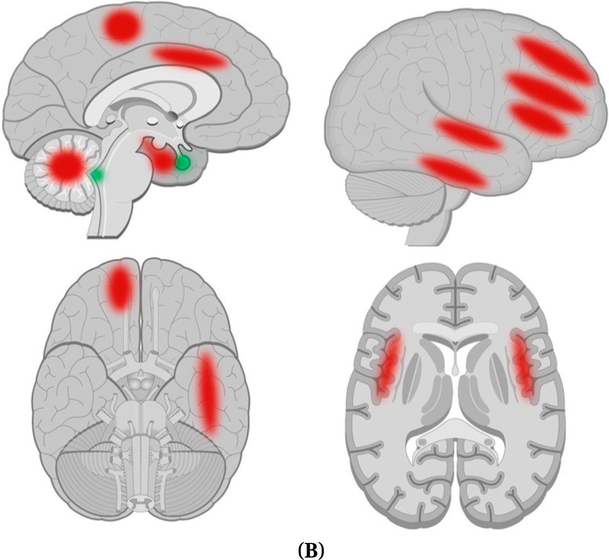 A Review of Potential Neuroimaging Biomarkers of Schizophrenia-Risk.