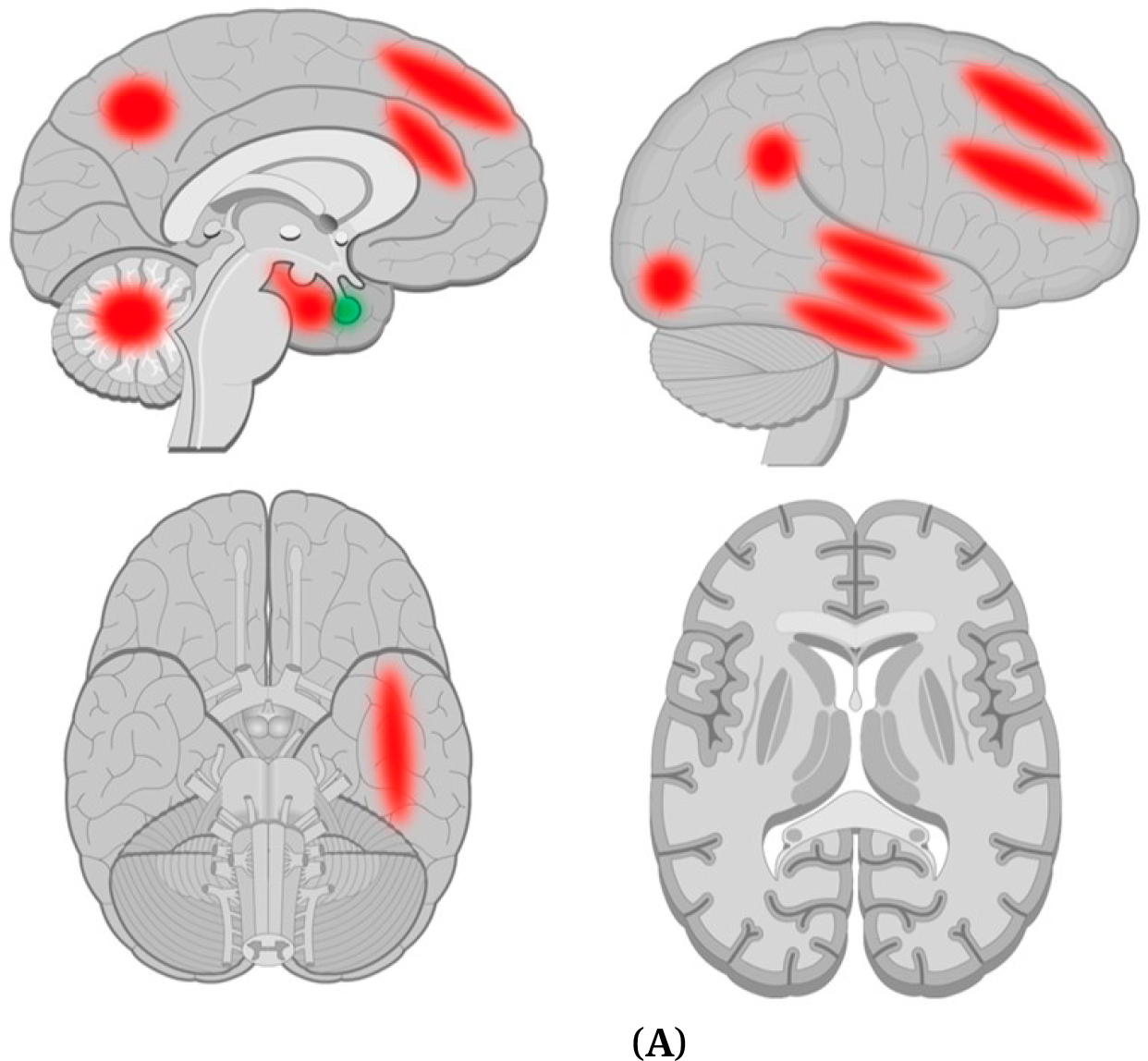 A Review of Potential Neuroimaging Biomarkers of Schizophrenia-Risk.