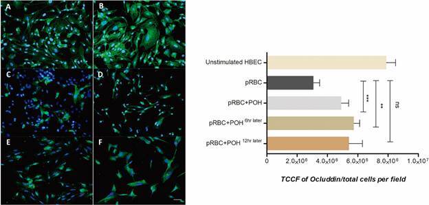 Perillyl alcohol modulates activation, permeability and integrity of human brain endothelial cells induced by Plasmodium falciparum.