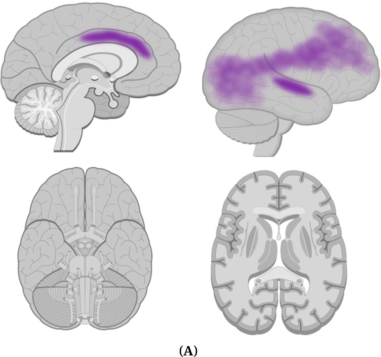 A Review of Potential Neuroimaging Biomarkers of Schizophrenia-Risk.