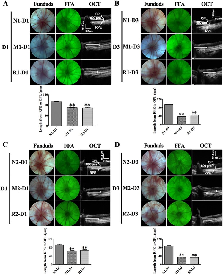 The impacts of resveratrol on the retinal degeneration in a rat model of retinitis pigmentosa induced by alkylation: an in-vivo study.