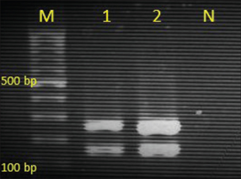 Phospholipase Activity of <i>Candida</i> Species Isolated from Diabetic Patients.