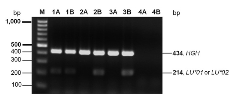 Identification of Lutheran Blood Groups and Genetic Variants within <i>KLF1</i> among Thai Blood Donors.