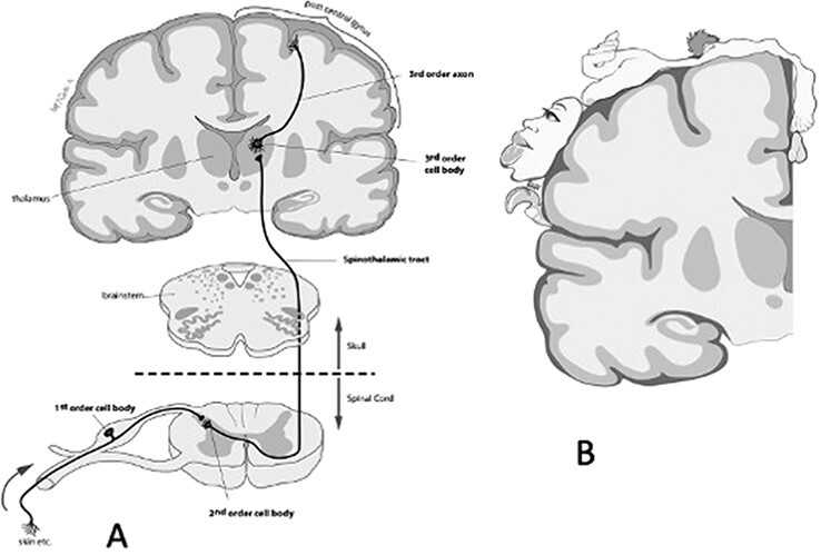 Toward the unknown: consciousness and pain.