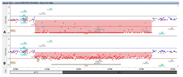 Xp21 contiguous gene deletion syndrome presenting as Duchenne muscular dystrophy and glycerol kinase deficiency associated with intellectual disability: case report and review literature.