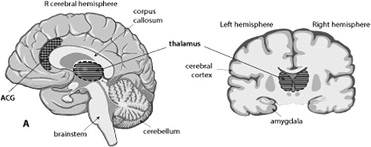 Toward the unknown: consciousness and pain.