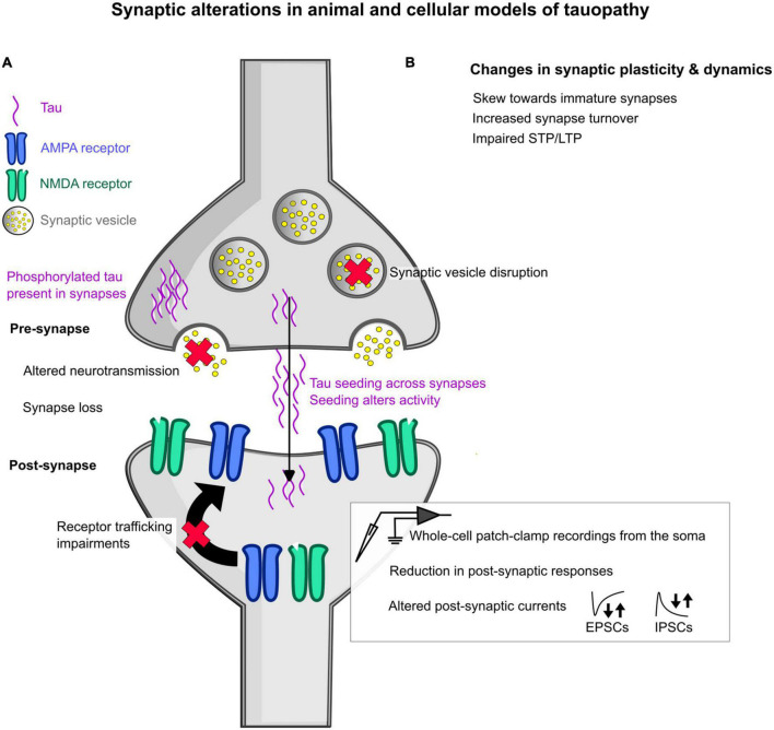 Alzheimer's disease as a synaptopathy: Evidence for dysfunction of synapses during disease progression.