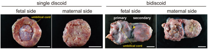 Similarities and differences in placental development between humans and cynomolgus monkeys.