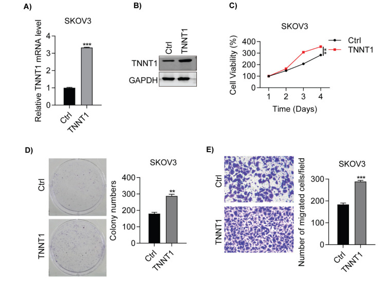 Troponin T1 Promotes the Proliferation of Ovarian Cancer by Regulating Cell Cycle and Apoptosis.