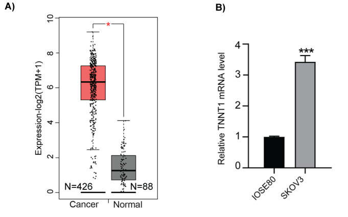 Troponin T1 Promotes the Proliferation of Ovarian Cancer by Regulating Cell Cycle and Apoptosis.