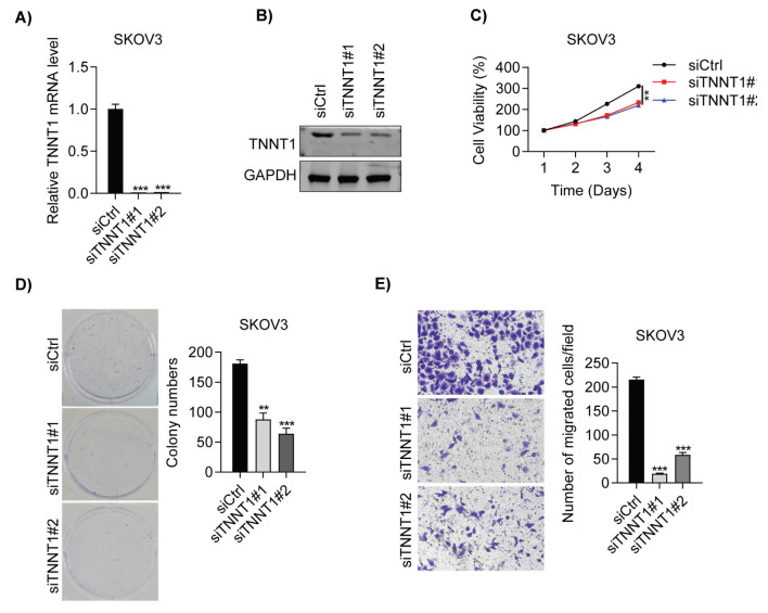 Troponin T1 Promotes the Proliferation of Ovarian Cancer by Regulating Cell Cycle and Apoptosis.