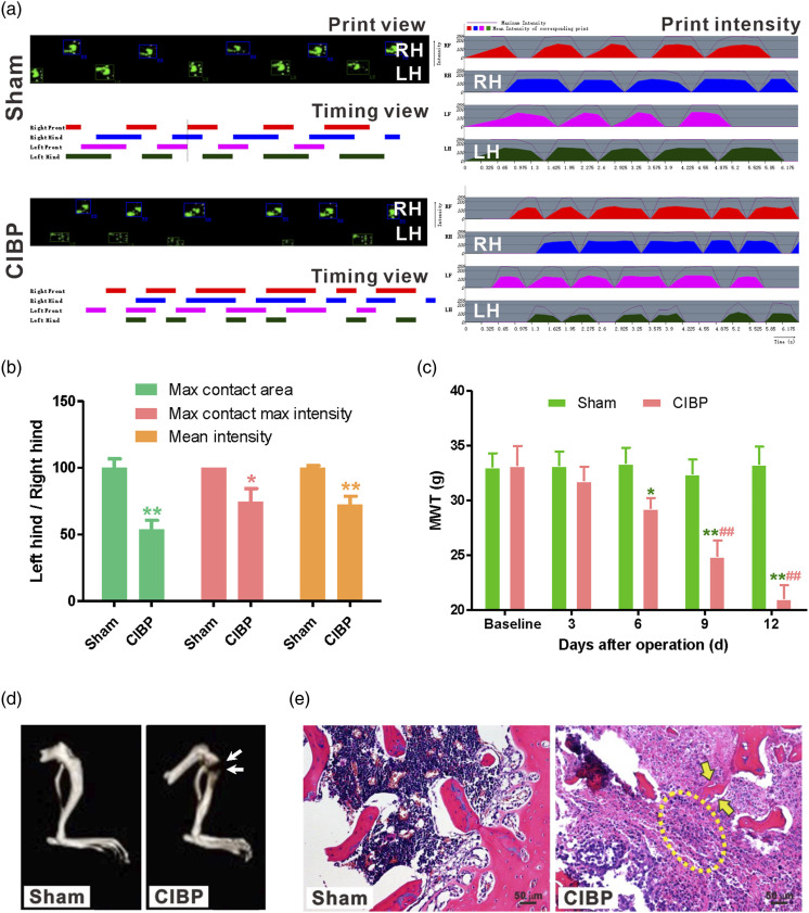 Epitranscriptomic profiling of N4-acetylcytidine-related RNA acetylation in the spinal dorsal horn of rat with cancer-induced bone pain.