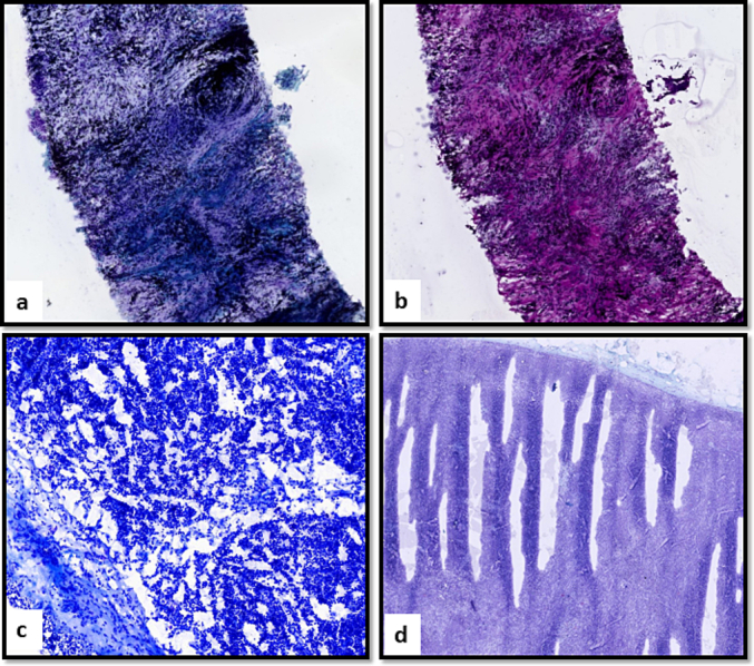 Validation of Remote Digital Pathology based diagnostic reporting of Frozen Sections from home