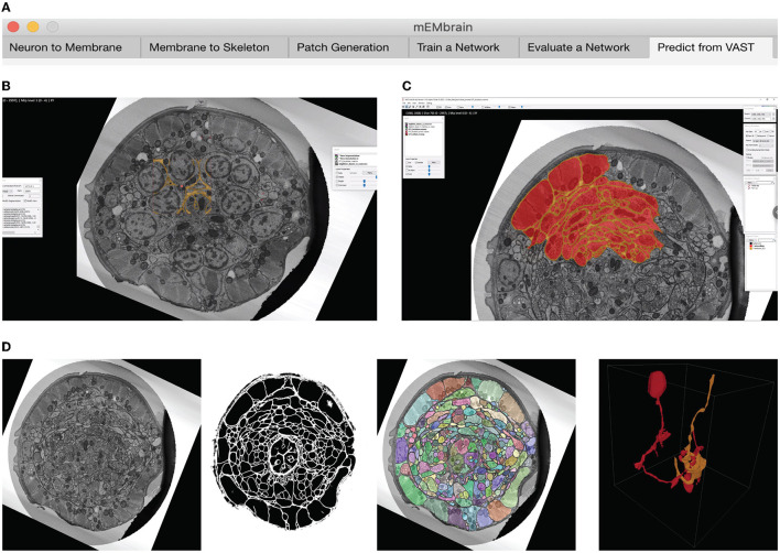 mEMbrain: an interactive deep learning MATLAB tool for connectomic segmentation on commodity desktops.