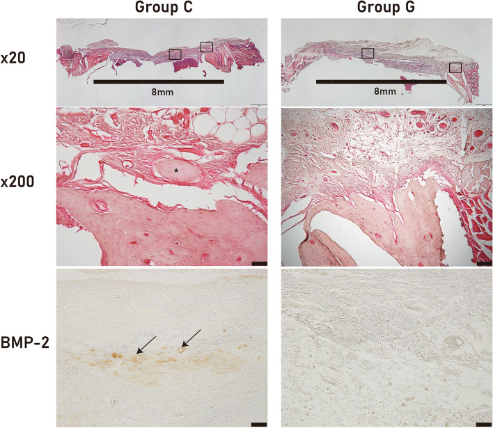 The optimal scaffold for silk sericin-based bone graft: collagen versus gelatin.