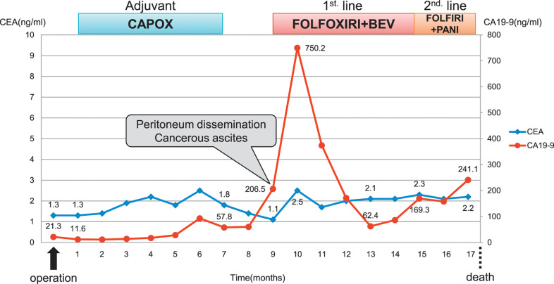 A Patient with Transverse Colon Cancer Complicated by Cowden Syndrome Administered FOLFOXIRI + Bevacizumab Therapy.