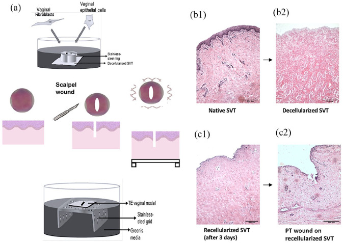 Estradiol-17β [E<sub>2</sub>] stimulates wound healing in a 3D in vitro tissue-engineered vaginal wound model.