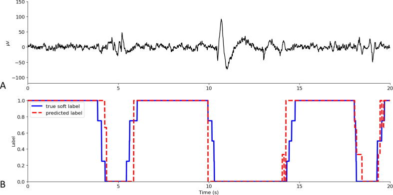 High performance clean versus artifact dry electrode EEG data classification using Convolutional Neural Network transfer learning