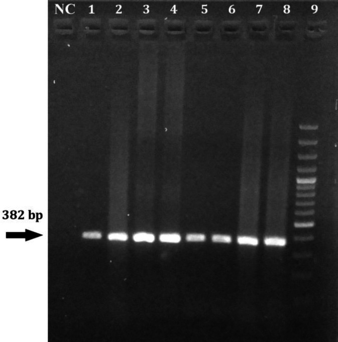 Evaluation of the relationship between inflammatory reaction and interleukins in ovine pulmonary adenocarcinomas.